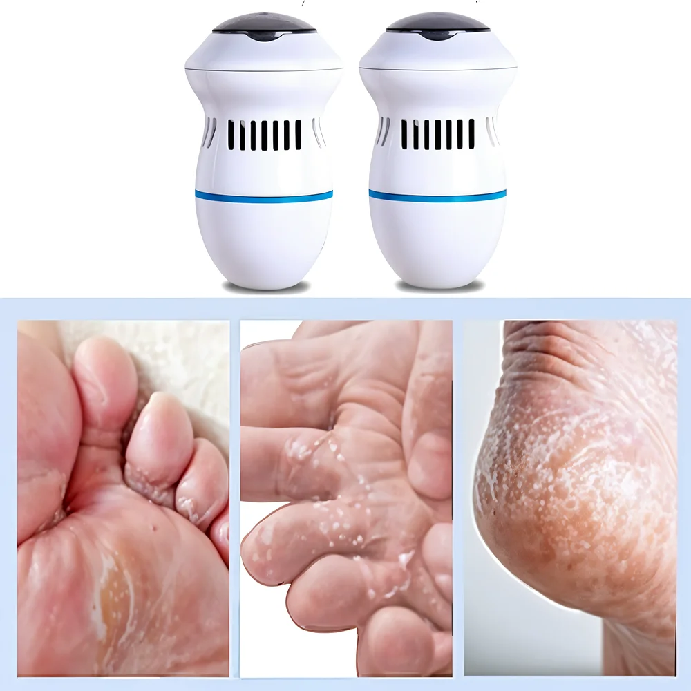 All-in-One Foot Care Solution